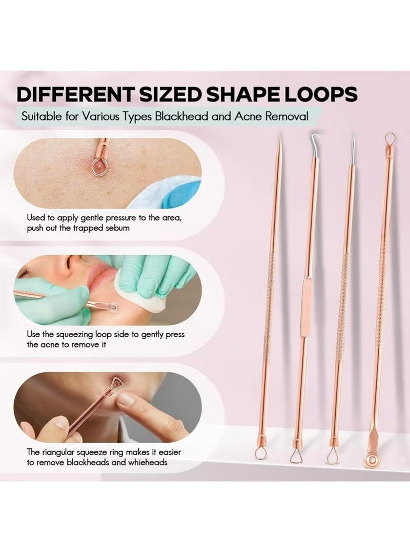 Uliova 4-Piece Stainless Steel Blackhead Remover Kit, Professional Pimple Popper & Comedone Extractor Tools, Acne & Whitehead Removal Set for Nose and Face - Image 3